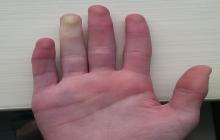 biały palec u ręki