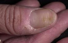 pofalowane paznokcie