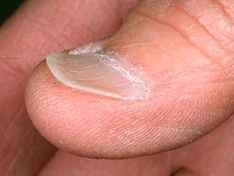 duży palec paznokieć