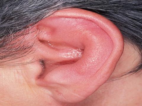 ucho zewnetrzne
